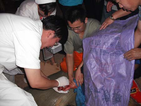 酒廠女職工右手被卡進(jìn)料管道 三門峽消防成功處置