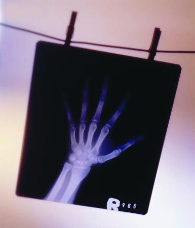 拍X光片時(shí)你穿防護(hù)服嗎？市民大多不知電離輻射危險(xiǎn)