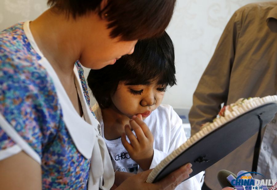 杭州：10歲輟學(xué)“毛孩”受關(guān)愛 接受面部激光脫毛