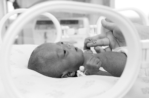 近50歲媽媽早產(chǎn)“拇指姑娘”:手掌僅指甲大小