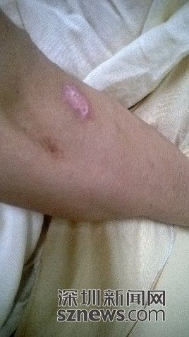 男子街頭遭兩名便衣警察毆打后被告知抓錯(cuò)人