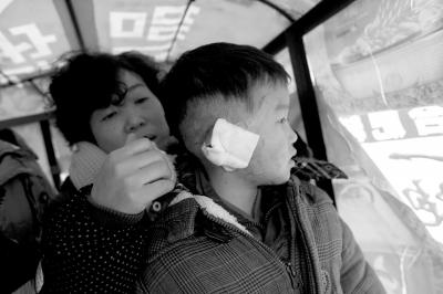 湖北男童遭二嬸割雙耳續(xù)：家里沒錢暫時(shí)出院