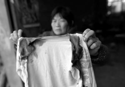 湖北男童遭二嬸割雙耳續(xù)：家里沒錢暫時(shí)出院