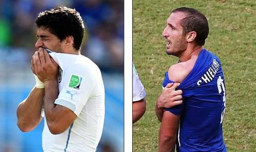 蘇神咬人的五大理由！