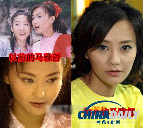 柳巖李小璐楊冪 女星整容前驚人對比照