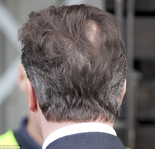 英國(guó)首相難逃白發(fā)魔咒 卡梅倫上任三月即白頭