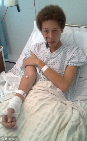 十字弓箭離奇自動(dòng)發(fā)射 英17歲男孩面部受傷險(xiǎn)些沒命