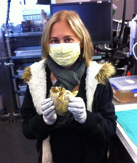 戰(zhàn)勝癌癥后留紀(jì)念 美國(guó)女孩手捧衰竭心臟合影