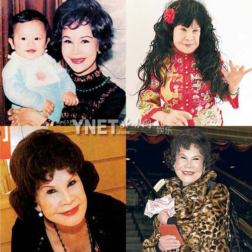 明星整容慘面癱 大S李小璐越發(fā)詭異