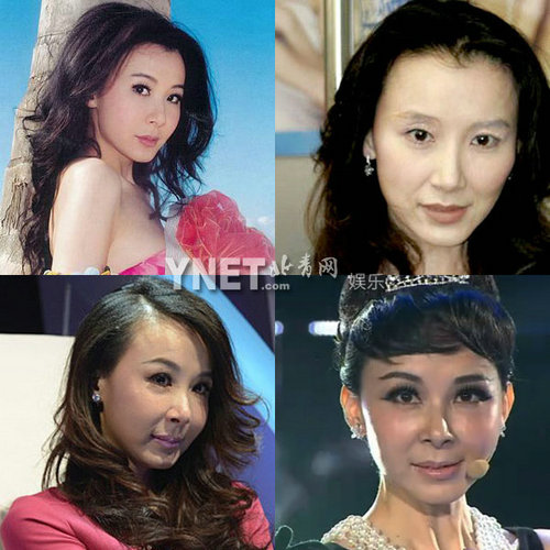 明星整容慘面癱 大S李小璐越發(fā)詭異