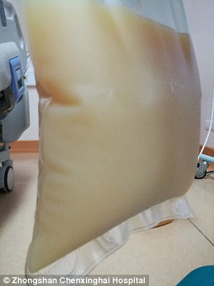 中山男子腹痛緊急送醫(yī)搶救，檢出“牛奶血”！